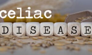 Expression of microRNAs in adults with celiac disease: a narrative review