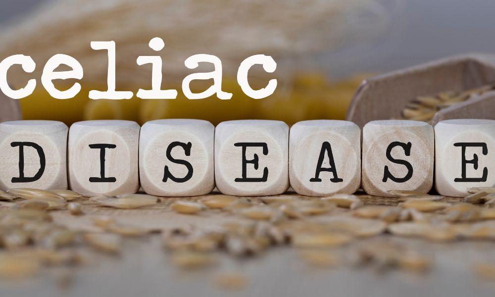 Expression of microRNAs in adults with celiac disease